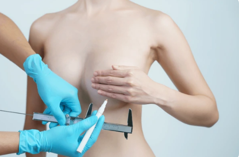  looking for breast reduction cape town or br  in Cape Town